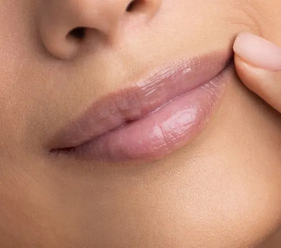 A close-up of lips receiving a filler treatment