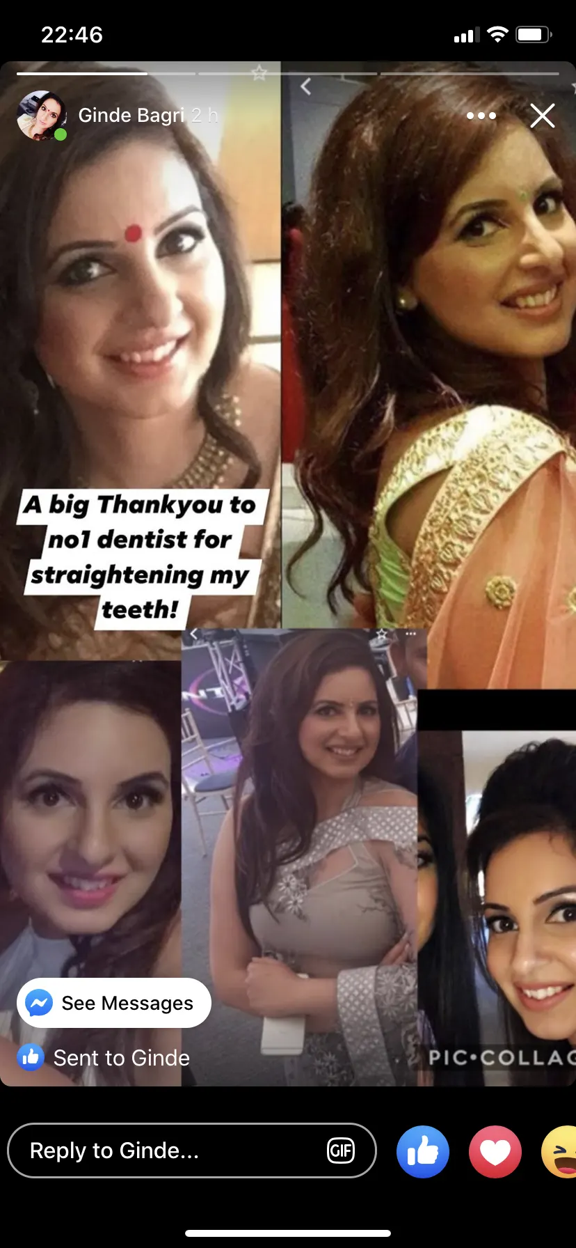 A patient smiling after orthodontic treatment at No1 (26 of 38)
